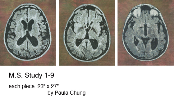M.S. Study Paula 3